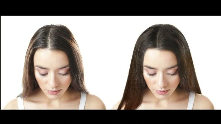 Hair Restoration From Beyond Stem Cells 1