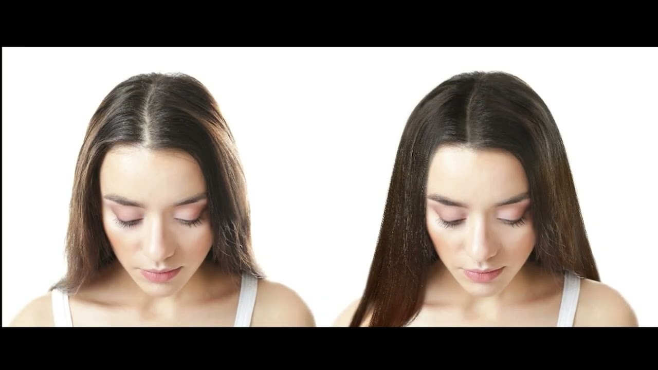 Hair Restoration From Beyond Stem Cells 1